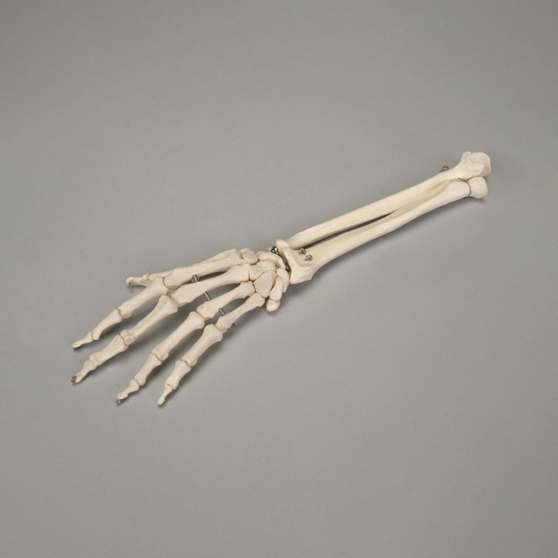 Huesos de Altay de la mano y el antebrazo (247705)