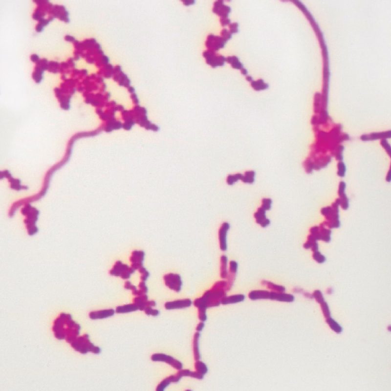 Tipos bacterianos | Portaobjetos preparados de microscopía (293946)