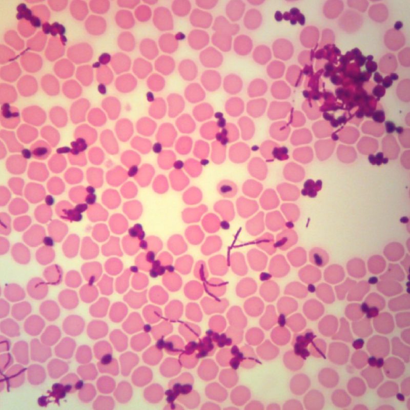 Frotis Mixto Bacilos, levaduras y células sanguíneas humanas | Preparaciones especiales de estructuras bacteriana, portaobjetos preparados de microscopio - Monerans, procariotas (294348)