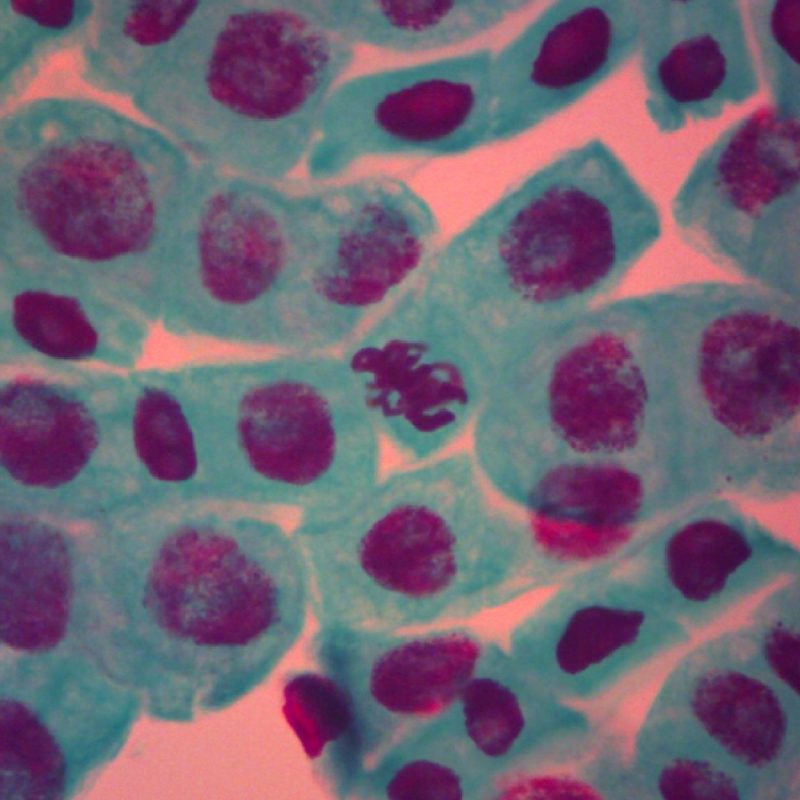 Punta de raíz de cebolla en mitosis | Portaobjetos preparados para microscopio (302432)